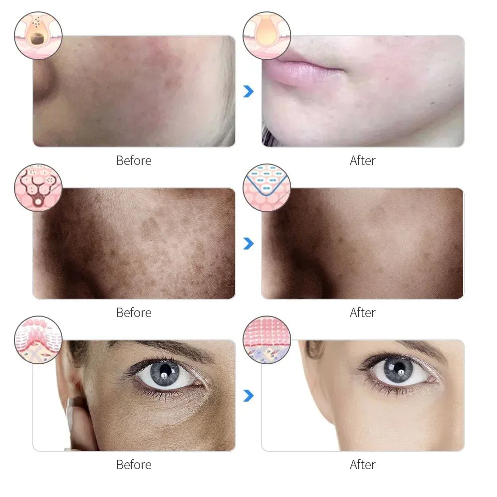 Therapeutic Facial LED Mask - TheSnapDrop